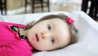 اكتشاف دور غريب لبروتين الدماغ يكشف أسرار مرض ألكسندر