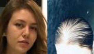 رحمة حسن تكشف جديد تساقط شعرها: جريمة قد تترك عاهة مستدامة