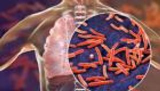 السل في 2025.. جينوم البكتيريا يروي قصة مقاومة سرية