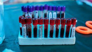 اختبار دم يكشف سرطان الرئة من خلية واحدة