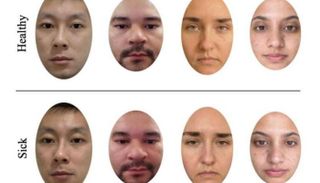 دراسة علمية تكشف أن النساء أكثر دقة من الرجال في تشخيص المرض من الوجوه