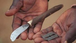 أدوات الختان- أرشيفية