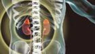 نتائج واعدة لتجربة سريرية.. لقاح شخصي يعالج سرطان الكلى بنجاح