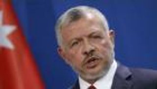 الملك عبدالله الثاني يخضع لعملية جراحية بسيطة