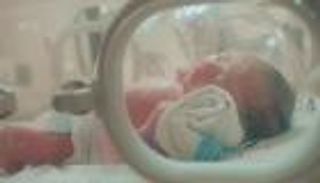 في واقعة طبية نادرة.. ولادة طفل يحمل جنينين داخل بطنه