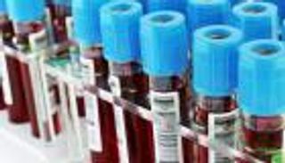 اكتشاف مذهل.. الخلايا البيضاء تسحب البكتيريا بالقوة وتدمرها