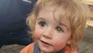 خطر فقدان البصر.. سبب صحي جديد لعدم تقبيل الأطفال (خاص)