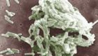 تفشي الليستيريا في بريطانيا.. الشوكولاتة بها سم قاتل