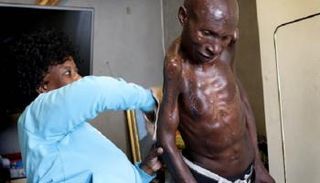 الطفرة في جين 