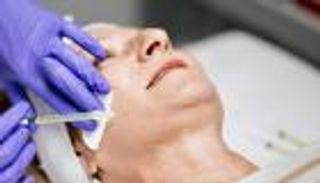 التهاب قاتل بالكلى.. تحذير جديد من مخاطر فيلر التجميل