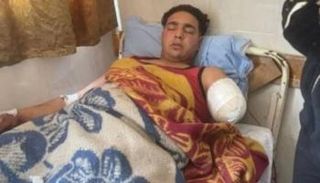 العامل المصاب في واقعة هجوم النمر