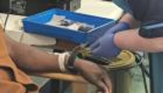 ثورة في علاج السرطان.. لقاح جديد للجلد بلا إبرة