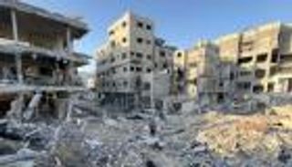 صورة طفل غزة «مبتور الذراعين» تفوز بجائزة عالمية