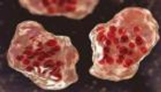 597 إصابة بالحصبة في تكساس منذ أواخر يناير