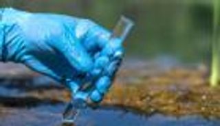 «ماء مقدس» ينقل الكوليرا إلى بريطانيا.. تحذيرات رسمية من تفشٍ نادر