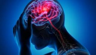 راكم مهول لجزيئات البلاستيك في ضحايا الجلطات