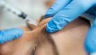 نصف وجه بلا تجاعيد.. طبيبة تثبت فعالية البوتوكس بطريقة غير تقليدية