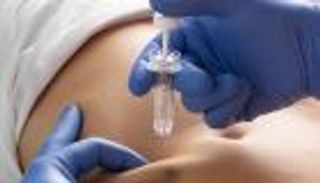 «حقنة خارقة» لعلاج السرطان في 5 دقائق فقط 