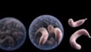 عدوى طفيلي خطير في ويلز.. مصابون يشبهون الأعراض بـ&laquo;بآلام الولادة&raquo;