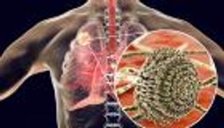 فطر قاتل يهدد الملايين.. تغير المناخ يفتح الطريق أمام «وباء صامت»