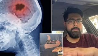 الطبيب "Medifectious" شرح في فيديو تفاصيل الاختبار