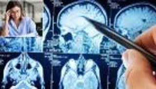 مخك تحت الضغط.. العمل المفرط يعيد تشكيل دماغك