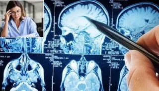 الإفراط في العمل لأكثر من 52 ساعة أسبوعياً يؤثر سلباً على بنية الدماغ