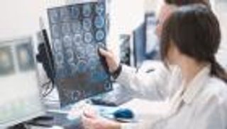 علماء روس يطورون مركبا دوائيا لوقف تطور الصرع دون آثار جانبية