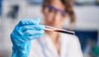 لأول مرة في العالم.. اختبار دم بديل للجراحة في تشخيص السرطان