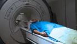 15 مليون مريض لا يعلمون بإصابتهم بالكبد الدهني الحاد في أمريكا وأوروبا