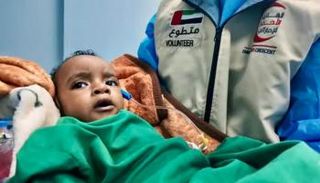 الأمل يعود لأسرة الطفل اليمني