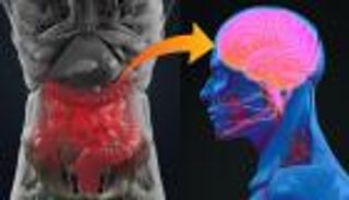 احذر رقائق البطاطس والمخبوزات.. أكلات تؤدي للإصابة بباركنسون القاتل