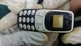 هاتف محمول في معدة مريض منذ عامين