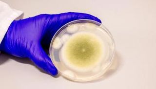 فطر  Aspergillus flavus 