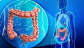 طبيب بريطاني يكشف ثلاثية غذائية تقي من سرطان الأمعاء