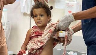 طفلة مصابة في غارة إسرائيلية على غزة