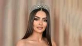  قبل اشتراكها بمسابقة ملكات الجمال.. رومي القحطاني تُصاب بتشوه في الوجه