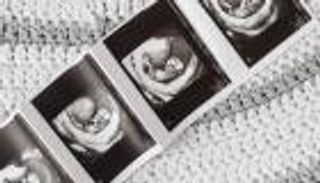 دراسة صادمة.. «السخام» في الهواء يغير بنية دماغ الجنين داخل الرحم