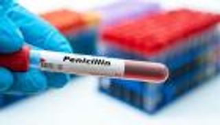 مفاجأة طبية.. الحساسية الشائعة قد تكون مجرد تشخيص خاطئ