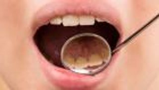 ابتكار مصري: أغشية تذوب في الفم لإصلاح الأسنان أثناء النوم (خاص)