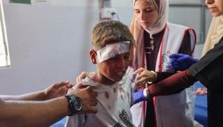 طفل فلسطيني مصاب في غزة - أ.ف.ب