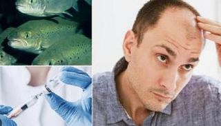 علاج جديد لنمو الشعر يعتمد على حيوانات منوية لسمك السلمون