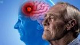 عالمة أعصاب تكشف: 8 عادات يومية تساعد على مقاومة ألزهايمر 