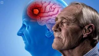 8 عادات يومية تساعد على مقاومة ألزهايمر 