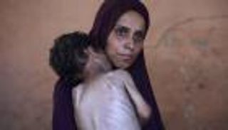 غزة تتضور جوعا.. وإسرائيل: «حماس تفتعل الأزمة»