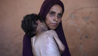 فلسطينية من غزة تحمل ابنها الذي يعاني من سوء التغذية