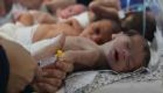 المجاعة أحالتهم لـ«عظم يكسوه جلد».. أطفال غزة «لا يقدرون حتى على البكاء»