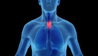 تطور في الكشف المبكر لسرطان المرىء