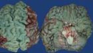 وصفه بالعلاج المعجزة.. وزير الصحة الأمريكي يروج لمادة تحول الجسم للون أزرق غامض