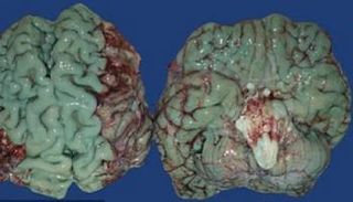 تحول أعضاء داخلية كالدماغ والقلب إلى لون أزرق غامض.